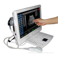 Price Ultrasound Scanner (MSLPU18)